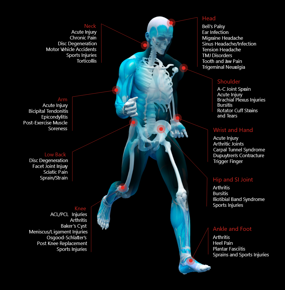 Class IV Laser Therapy